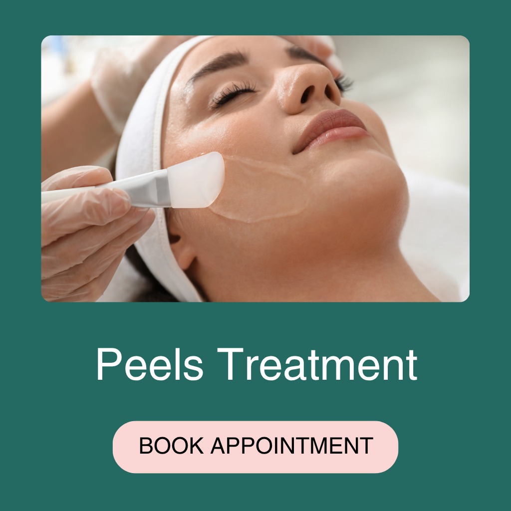 Peels Treatment