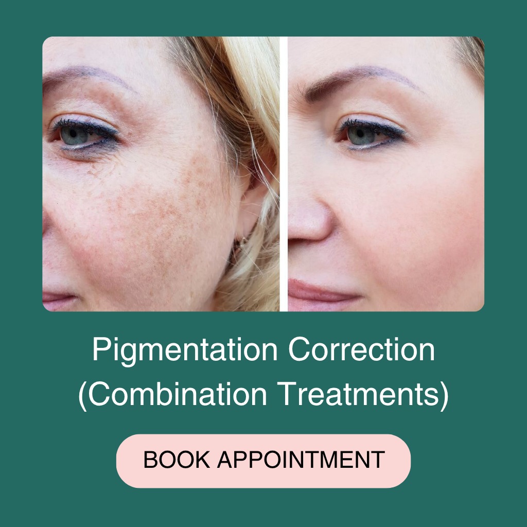Pigmentation