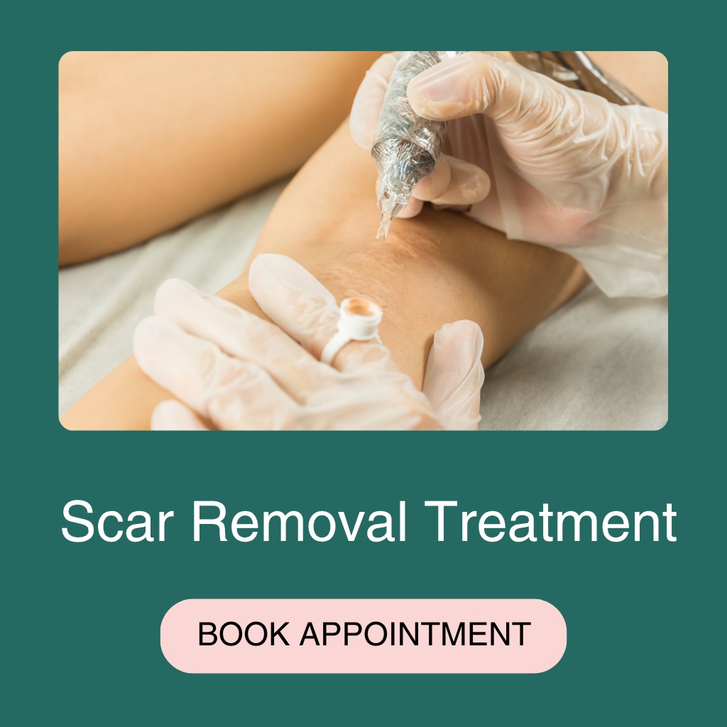 Scar Removel