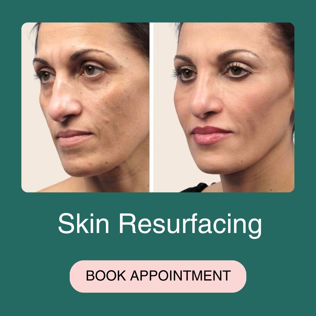 Skin Resurfacing